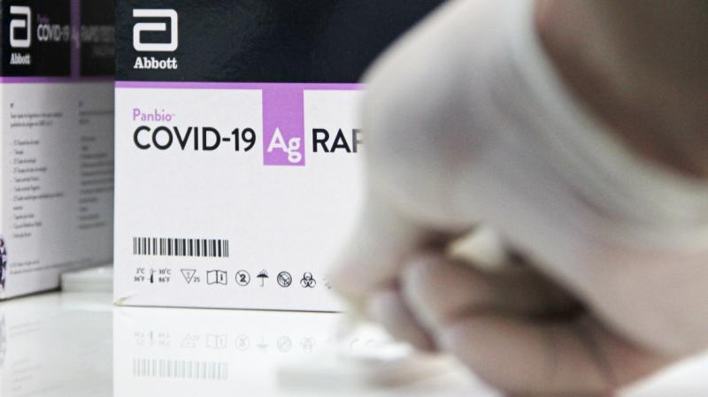 Brindan recomendaciones para el uso de test de antígenos.