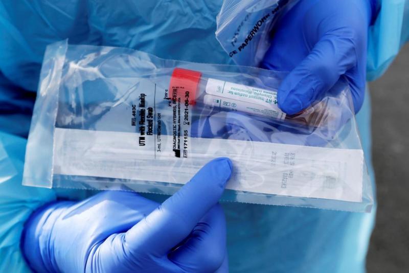 ANMAT aprobó la venta del test rápido de Covid.