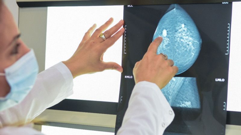 El de mama es uno de los cánceres más comunes en Santa Fe. Se puede detectar a tiempo con estudios como ecografía y mamografía .