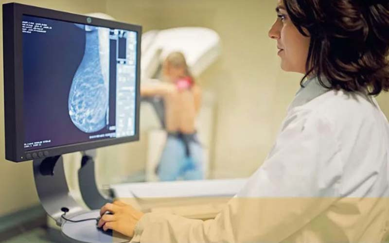 Más de 400 mujeres del departamento San Martín participaron de la campaña de mamografías gratuitas realizada en octubre, con estudios efectuados en los SAMCo de Sastre y San Jorge.